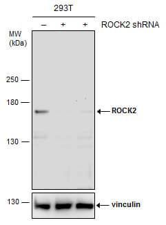 <b>Genetic Strategies Validation. </b>Non-transfected (-) and transfected (+) 293T whole cell extracts (30 ug) were separated by 5% SDS-PAGE, and the membrane was blotted with ROCK2 antibody [N3C1], Internal (NBP2-20199) diluted at 1:1000. The HRP-conjugated anti-rabbit IgG antibody  was used to detect the primary antibody. 