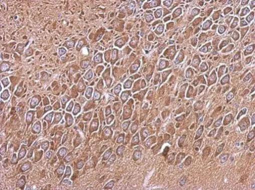 Immunohistochemical analysis of paraffin-embedded CL1-5 xenograft, using RP105(NBP2-20205) antibody at 1:500 dilution. br>Antigen Retrieval: Trilogy(TM) (EDTA based, pH 8.0) buffer, 15min 