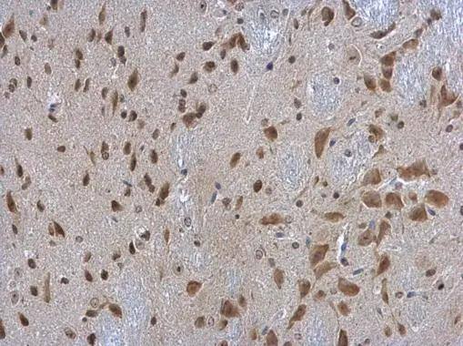 RPL3 antibody [N3C3] detects RPL3 protein at cytoplasm in mouse brain by immunohistochemical analysis. Sample: Paraffin-embedded mouse brain. RPL3 antibody [N3C3] (NBP2-20214) diluted at 1:500. br>Antigen Retrieval: Citrate buffer, pH 6.0, 15 min 
