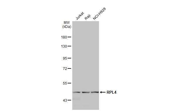 Various whole cell extracts (30 ug) were separated by 7.5% SDS-PAGE, and the membrane was blotted with RPL4 antibody (NBP2-20215) diluted at 1:1000. The HRP-conjugated anti-rabbit IgG antibody  was used to detect the primary antibody. 