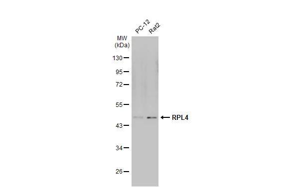Various whole cell extracts (30 ug) were separated by 10% SDS-PAGE, and the membrane was blotted with RPL4 antibody (NBP2-20215) diluted at 1:1000. The HRP-conjugated anti-rabbit IgG antibody  was used to detect the primary antibody. 