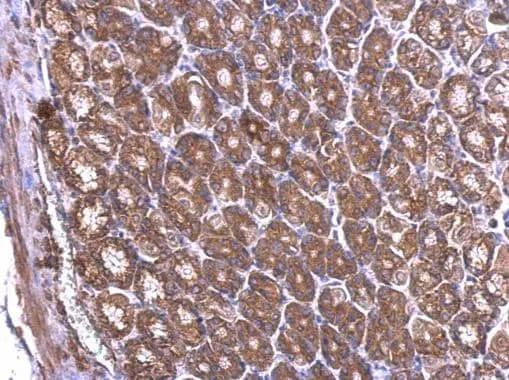 Immunohistochemistry RPL6 Antibody
