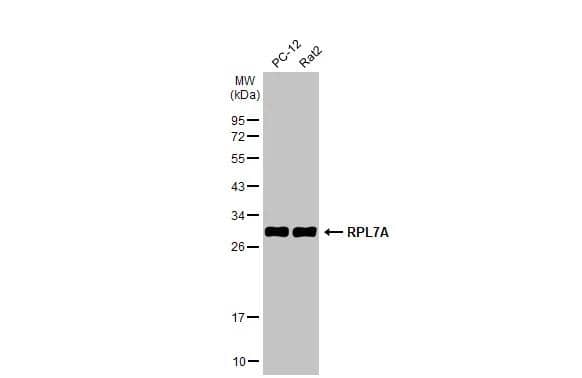 Various whole cell extracts (30 ug) were separated by 12% SDS-PAGE, and the membrane was blotted with RPL7A antibody (NBP2-20217) diluted at 1:1000. The HRP-conjugated anti-rabbit IgG antibody  was used to detect the primary antibody. 