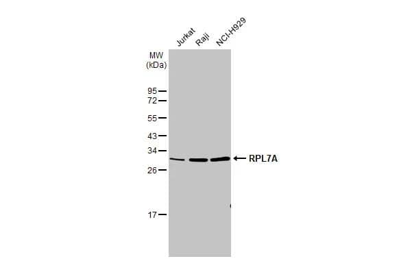 Various whole cell extracts (30 ug) were separated by 12% SDS-PAGE, and the membrane was blotted with RPL7A antibody (NBP2-20217) diluted at 1:1000. The HRP-conjugated anti-rabbit IgG antibody  was used to detect the primary antibody. 