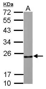 Western Blot: RPL9 Antibody [NBP2-20219] - Sample (30 ug of whole cell lysate)  A: Zebrafish muscle  12% SDS PAGE  NBP2-20219 diluted at 1:1000 