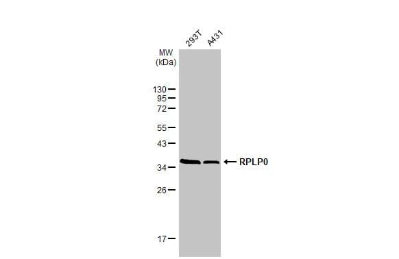 Various whole cell extracts (30 ug) were separated by 12% SDS-PAGE, and the membrane was blotted with RPLP0 antibody (NBP2-20220) diluted at 1:1000. The HRP-conjugated anti-rabbit IgG antibody  was used to detect the primary antibody. 