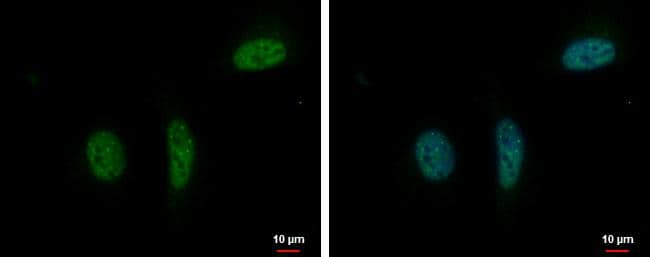 Immunocytochemistry/ Immunofluorescence RPRD1B Antibody - BSA Free