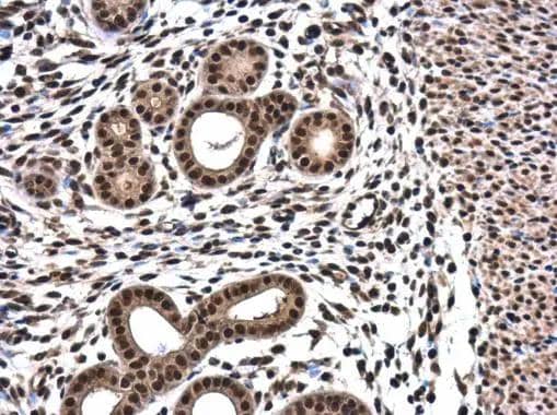 Immunohistochemistry-Paraffin RPRD1B Antibody - BSA Free