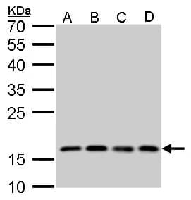 Western Blot: RPS15 Antibody [NBP2-20223] - RPS15 antibody detects RPS15  protein by Western blot analysis.A. 30 ug U87-MG whole cell lysate/extractB. 30 ug SK-N-SH whole cell lysate/extractC. 30 ug IMR32 whole cell lysate/extractD. 30 ug SK-N-AS whole cell lysate/extract12 % SDS-PAGERPS15 antibody (NBP2-20223) dilution: 1:1000