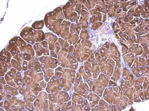 RPS15 antibody detects RPS15 protein at cytosol on mouse prostate by immunohistochemical analysis. Sample: Paraffin-embedded mouse prostate. RPS15 antibody (NBP2-20223) dilution: 1:500.Antigen Retrieval: Trilogy(TM) (EDTA based, pH 8.0) buffer, 15min 