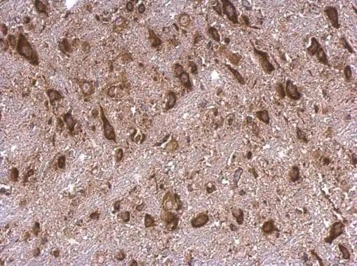 RPS15 antibody detects RPS15 protein at cytosol on mouse hind brain by immunohistochemical analysis. Sample: Paraffin-embedded mouse hind brain. RPS15 antibody (NBP2-20223) dilution: 1:500.Antigen Retrieval: Trilogy(TM) (EDTA based, pH 8.0) buffer, 15min 