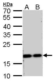 RPS15 antibody detects RPS15 protein by Western blot analysis.A. 30 ug MCF-7 whole cell lysate/extract B. 30 ug MDA-MB-231 whole cell lysate/extractC. 30 ug IMR32 whole cell lysate/extractD. 30 ug SK-N-AS whole cell lysate/extract12 % SDS-PAGERPS15 antibody (NBP2-20223) dilution: 1:1000 