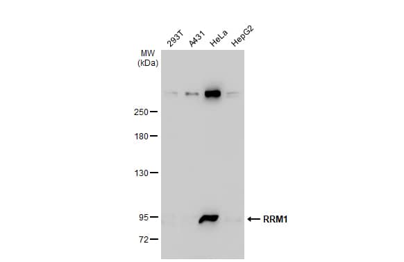 Western Blot: RRM1 Antibody [NBP2-20231] - Various whole cell extracts (30 ug) were separated by 5% SDS-PAGE, and the membrane was blotted with RRM1 antibody (NBP2-20231) diluted at 1:5000. The HRP-conjugated anti-rabbit IgG antibody  was used to detect the primary antibody.