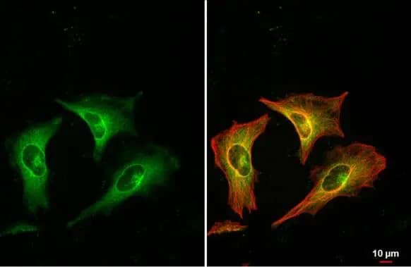 Immunocytochemistry/ Immunofluorescence: RRM1 Antibody [NBP2-20231] - RRM1 antibody detects RRM1 protein at cytoplasm by immunofluorescent analysis.Sample: HeLa cells were fixed in ice-cold MeOH for 5 min.Green: RRM1  stained by RRM1 antibody (NBP2-20231) diluted at 1:500.Red: alpha Tubulin, a cytoskeleton marker, stained by alpha Tubulin antibody [GT114]  diluted at 1:1000.