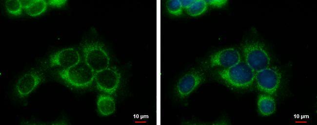 RRM1 antibody detects RRM1 protein at cytoplasm by immunofluorescent analysis.Sample: MCF-7 cells were fixed in ice-cold MeOH for 5 min.Green: RRM1 protein stained by RRM1 antibody (NBP2-20231) diluted at 1:1000.Blue: Hoechst 33342 staining. 