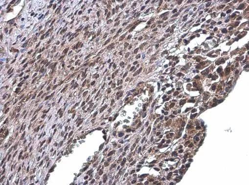 Immunohistochemistry-Paraffin RSK2 Antibody
