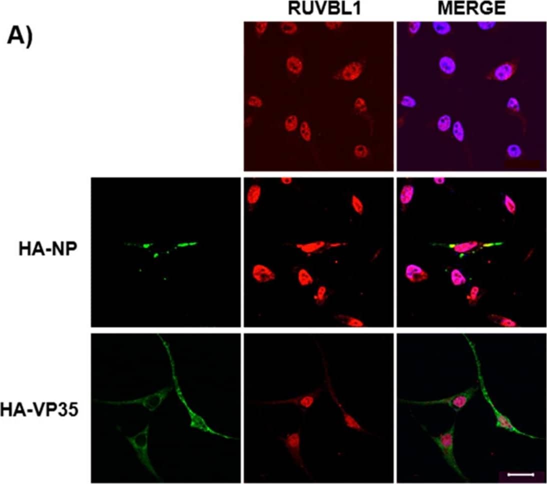 Immunocytochemistry/ Immunofluorescence: RUVBL1 Antibody [NBP2-20245] - Endogenous RUVBL1 & RUVBL2 colocalize with HA-NP. HeLa cells were transfected with vector control, HA-NP, or HA-VP35. Twenty-four h later, the cells were fixed & processed for immunofluorescence detection of endogenous RUVBL1 or RUVBL2 in the presence of vector control, HA-NP, or HA-VP35. Representative images of (A) endogenous RUVBL1 localization pattern with control vector (top panels), HA-NP (middle panels), or HA-VP35 (bottom panels) & (B) endogenous RUVBL2 localization pattern with control vector (top panels), HA-NP (middle panels), or HA-VP35 (bottom panels) are shown. HA-NP or HA-VP35 (green), RUVBL1/2 (red), & Hoechst 33342 nuclear stain (blue) were visualized by confocal microscopy. Scale bars = 20 µM. Image collected & cropped by CiteAb from the following publication (//pubmed.ncbi.nlm.nih.gov/31018511), licensed under a CC-BY license. Not internally tested by Novus Biologicals.