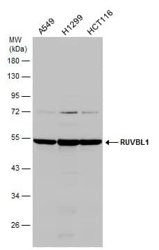 Western Blot: RUVBL1 Antibody [NBP2-20245] - Various whole cell extracts (30 ug) were separated by 10% SDS-PAGE, and the membrane was blotted with RUVBL1 antibody (NBP2-20245) diluted at 1:1000.