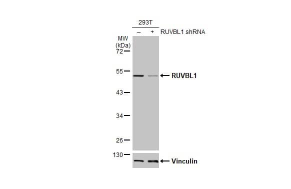 <b>Genetic Strategies Validation. </b>Non-transfected (-) and transfected (+) 293T whole cell extracts (30 ug) were separated by 10% SDS-PAGE, and the membrane was blotted with RUVBL1 antibody (NBP2-20245) diluted at 1:5000. The HRP-conjugated anti-rabbit IgG antibody  was used to detect the primary antibody. 