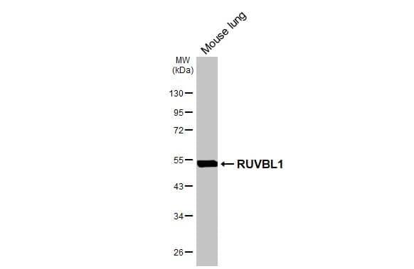 Mouse tissue extract (50 ug) was separated by 10% SDS-PAGE, and the membrane was blotted with RUVBL1 antibody (NBP2-20245) diluted at 1:1000. The HRP-conjugated anti-rabbit IgG antibody  was used to detect the primary antibody. 