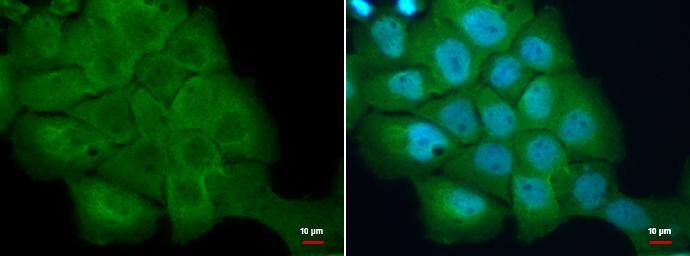 S100A2 antibody [N1C3] detects S100A2 protein at cytoplasm and nucleus by immunofluorescent analysis. Sample: A431 cells were fixed in 4% paraformaldehyde/PBS for 15 min.Green: S100A2 protein stained by S100A2 antibody [N1C3] (NBP2-20247) diluted at 1:500.Blue: Hoechst 33342 staining. 