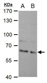 SAM68 antibody [N2C3] detects SAM68 protein by western blot analysis.A. 30 ug PC-12 whole cell extract B. 30 ug Rat2 whole cell extract7.5 % SDS-PAGESAM68 antibody [N2C3] (NBP2-20254) dilution: 1:3000 