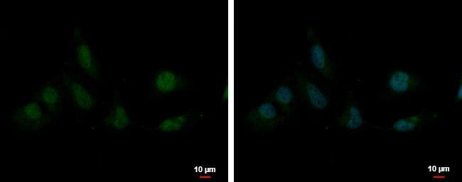 SAP130 antibody [N1N2], N-term detects SAP130 protein at nucleus by immunofluorescent analysis.Sample: HeLa cells were fixed in 4% paraformaldehyde at RT for 15 min.Green: SAP130 protein stained by SAP130 antibody [N1N2], N-term (NBP2-20259) diluted at 1:1000.Blue: Hoechst 33342 staining.Scale bar = 10 um. 
