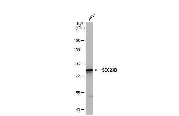 Whole cell extract (30 ug) was separated by 7.5% SDS-PAGE, and the membrane was blotted with SEC23B antibody [N1N2], N-term (NBP2-20279) diluted at 1:5000. The HRP-conjugated anti-rabbit IgG antibody  was used to detect the primary antibody. 