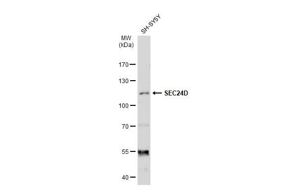 Whole cell extract (30 ug) was separated by 7.5% SDS-PAGE, and the membrane was blotted with SEC24D antibody [C2C3], C-term (NBP2-20280) diluted at 1:1000. The HRP-conjugated anti-rabbit IgG antibody  was used to detect the primary antibody. 