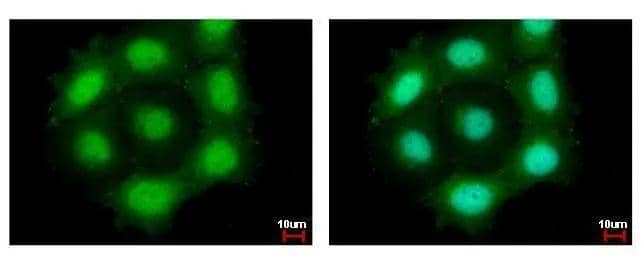 Securin antibody detects PTTG1 protein at cytoplasm and nucleus by immunofluorescent analysis. Sample: MCF-7 cells were fixed in 4% paraformaldehyde at RT for 15 min.Green: PTTG1 protein stained by Securin antibody (NBP2-20287) diluted at 1:500.Blue: Hoechst 33342 staining. 