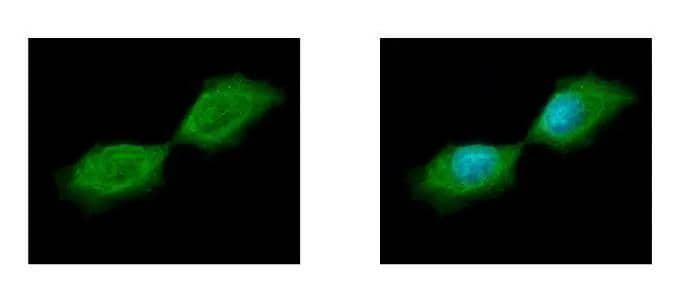 Immunocytochemistry/ Immunofluorescence Septin-12 Antibody - BSA Free