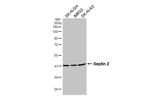 Various whole cell extracts (30 ug) were separated by 10% SDS-PAGE, and the membrane was blotted with Septin 2 antibody (NBP2-20301) diluted at 1:1000. The HRP-conjugated anti-rabbit IgG antibody  was used to detect the primary antibody. 