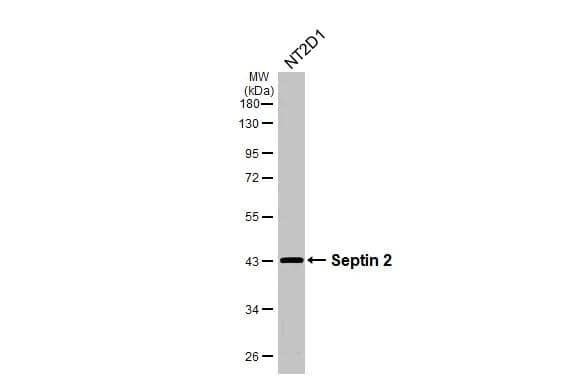 Whole cell extract (30 ug) was separated by 10% SDS-PAGE, and the membrane was blotted with Septin 2 antibody (NBP2-20301) diluted at 1:1000. The HRP-conjugated anti-rabbit IgG antibody  was used to detect the primary antibody. 