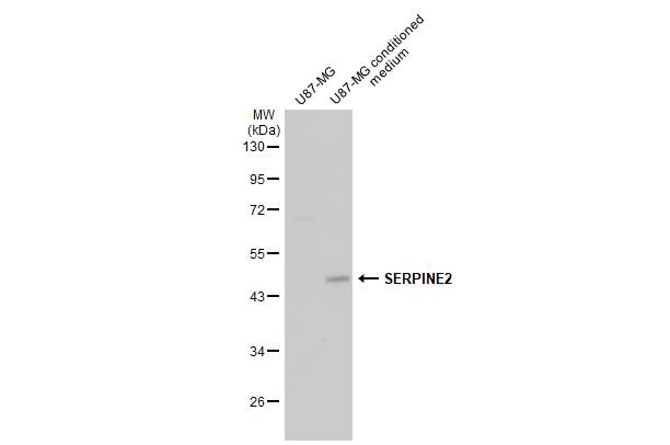 Western Blot: Serpin E2/PN1 Antibody [NBP2-20314] - U87-MG whole cell extract and conditioned medium (30 ug) were separated by 10% SDS-PAGE, and the membrane was blotted with Serpin E2/PN1 antibody (NBP2-20314) diluted at 1:5000. The HRP-conjugated anti-rabbit IgG antibody  was used to detect the primary antibody.