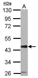 Sample (50 ug of whole cell lysate) A: mouse brain 10% SDS PAGE NBP2-20315 diluted at 1:2000 The HRP-conjugated anti-rabbit IgG antibody  was used to detect the primary antibody. 