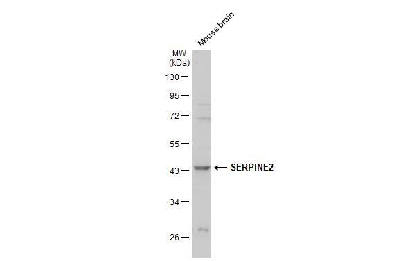 Mouse tissue extract (50 ug) was separated by 10% SDS-PAGE, and the membrane was blotted with SERPINE2 antibody (NBP2-20315) diluted at 1:2000. The HRP-conjugated anti-rabbit IgG antibody  was used to detect the primary antibody. 