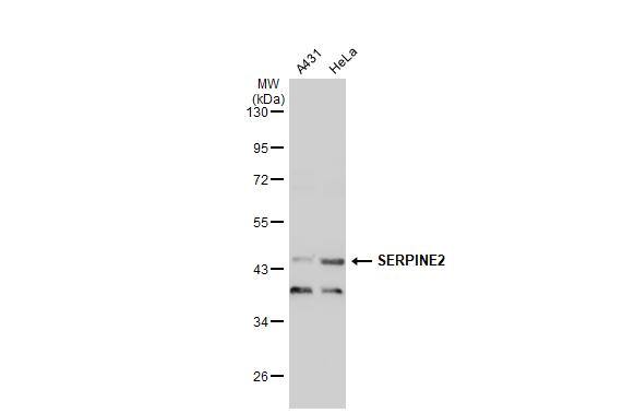 Various whole cell extracts (30 ug) were separated by 10% SDS-PAGE, and the membrane was blotted with SERPINE2 antibody (NBP2-20315) diluted at 1:2000. The HRP-conjugated anti-rabbit IgG antibody  was used to detect the primary antibody. 