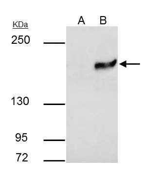 SETDB1 antibody [N1], N-term immunoprecipitates SETDB1 protein in IP experiments.IP samples: HeLa nuclear extractA. Control with 4 ug of preimmune Rabbit IgGB. Immunoprecipitation of SETDB1 protein by 4 ug SETDB1 antibody [N1], N-term (NBP2-20321)5 % SDS-PAGEThe immunoprecipitated SETDB1 protein was detected by SETDB1 antibody [N1], N-term (NBP2-20321) diluted at 1:1000.[EasyBlot anti-rabbit IgG  was used as a secondary reagent] 