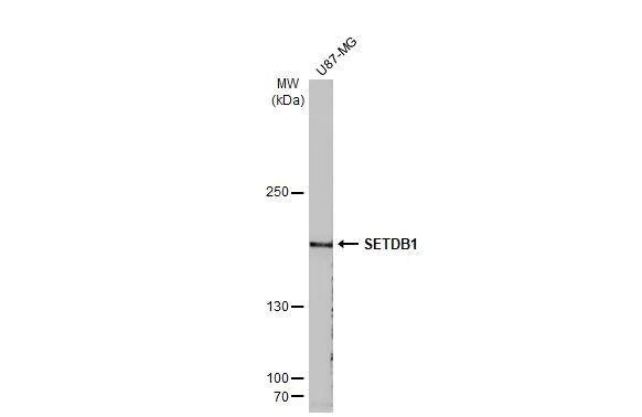 Whole cell extract (30 ug) was separated by 5% SDS-PAGE, and the membrane was blotted with SETDB1 antibody [N1], N-term (NBP2-20321) diluted at 1:2000. The HRP-conjugated anti-rabbit IgG antibody  was used to detect the primary antibody. 
