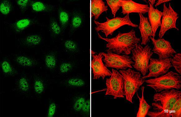 SETDB1 antibody [N2C1], Internal detects SETDB1 protein at nucleus by immunofluorescent analysis.Sample: HeLa cells were fixed in 4% paraformaldehyde at RT for 15 min.Green: SETDB1 stained by SETDB1 antibody [N2C1], Internal (NBP2-20322) diluted at 1:500.Red: alpha Tubulin, a cytoskeleton marker, stained by alpha Tubulin antibody [GT114]  diluted at 1:1000.Scale bar= 10um. 
