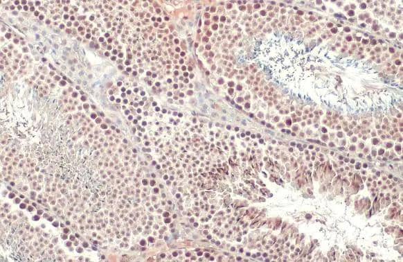 SETDB1 antibody [N2C1], Internal detects SETDB1 protein at nucleus by immunohistochemical analysis.Sample: Paraffin-embedded mouse testis.SETDB1 stained by SETDB1 antibody [N2C1], Internal (NBP2-20322) diluted at 1:500.Antigen Retrieval: Citrate buffer, pH 6.0, 15 min 