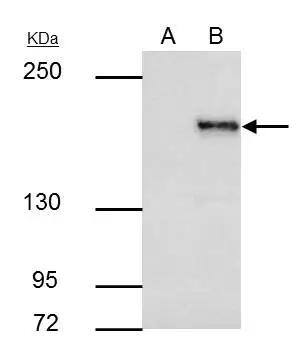SETDB1 antibody [N2C1], Internal immunoprecipitates SETDB1 protein in IP experiments.IP samples: HeLa nuclear extractA. Control with 4 ug of preimmune Rabbit IgGB. Immunoprecipitation of SETDB1 protein by 4 ug SETDB1 antibody [N2C1], Internal (NBP2-20322)5 % SDS-PAGEThe immunoprecipitated SETDB1 protein was detected by SETDB1 antibody [N2C1], Internal (NBP2-20322) diluted at 1:1000.[EasyBlot anti-rabbit IgG  was used as a secondary reagent] 