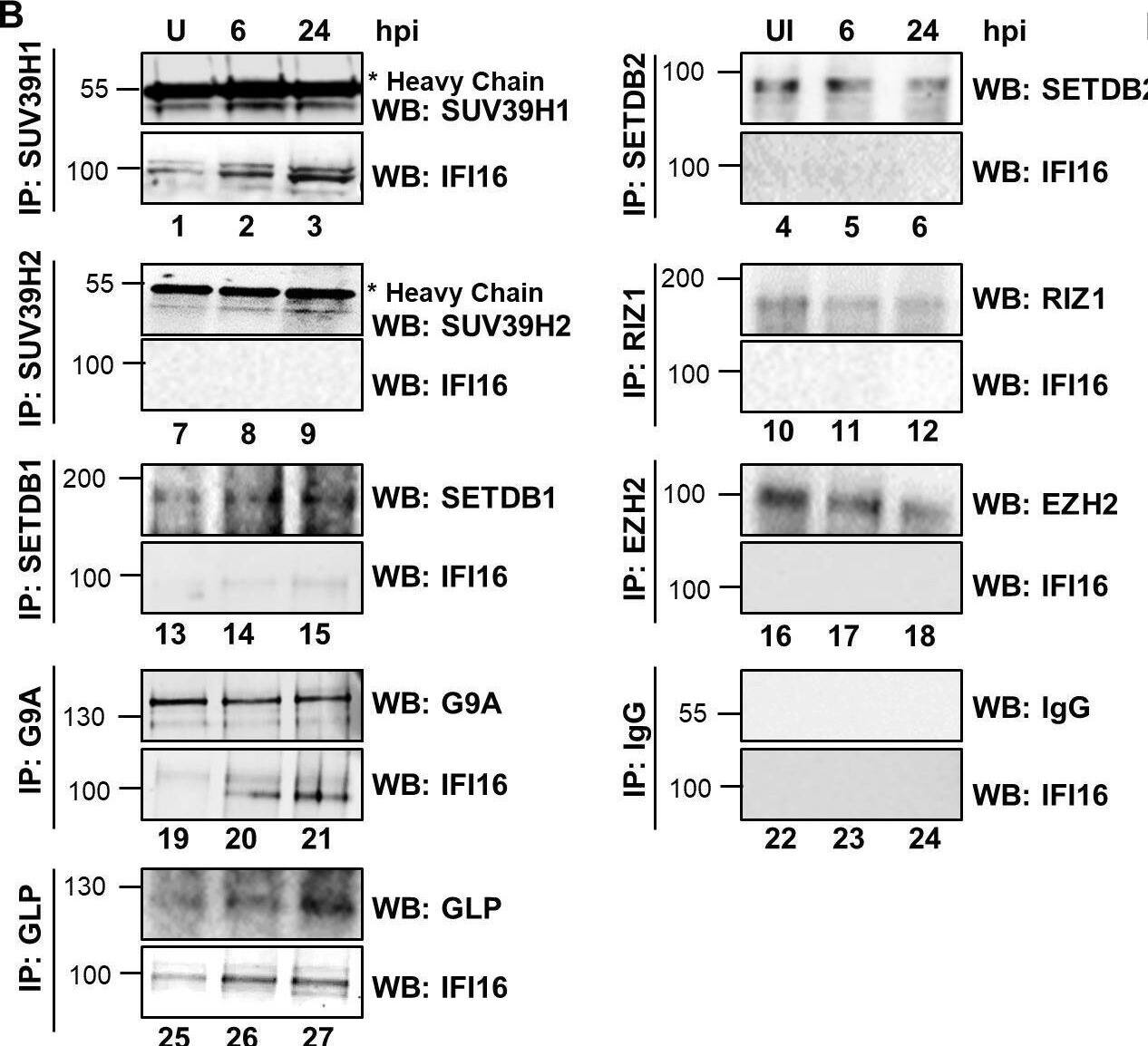 Demonstration of IFI16’s interaction and recruitment of specific H3K9 MTases during de novo KSHV infection.(A) TIME cells either left uninfected or infected with KSHV for 6 or 24 hr were IPed with anti-IFI16 antibodies and western blotted for the indicated proteins. (B) To confirm IFI16’s interaction with H3K9 MTases, TIME cells were infected as in (A) and IPed with antibodies against the MTases and blotted for the corresponding MTase and IFI16. (C) 293 T cells lacking IFI16 transfected with control plasmid or His-IFI16 expressing plasmid for 72 hr were utilized for His-tag pulldown using HisPur cobalt resin. Inputs and elutions were blotted for the indicated proteins. (D) 293 T cells transfected with control plasmid, IFI16 expressing plasmid or LANA expressing plasmid for 72 hr were IPed with anti-IFI16 mAb or LANA mAb. Inputs and elutions were blotted for the indicated proteins. Image collected and cropped by CiteAb from the following open publication (//pubmed.ncbi.nlm.nih.gov/31682228), licensed under a CC-BY license. Not internally tested by Novus Biologicals.