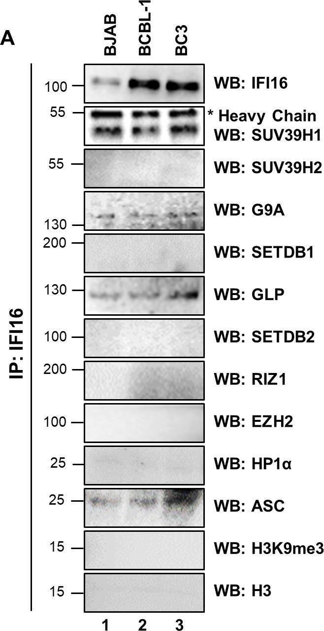 Demonstration of IFI16’s interaction with specific H3K9 MTases in KSHV latently infected PEL (BCBL-1 and BC-3) cells and in uninfected control BJAB cells.(A) Nuclear fractions were isolated from latently infected cells and uninfected BJAB cells and treated with Benzonase. IPs were performed using anti-IFI16 mAb and LANA mAb and WBs were performed. (B) To confirm IFI16’s and LANA’s interaction with H3K9 MTases, IPs were done with Abs against the H3K9 MTases and blotted for the corresponding MTase, IFI16, LANA and HP1 alpha  (heterochromatin protein 1 alpha ). Image collected and cropped by CiteAb from the following open publication (//pubmed.ncbi.nlm.nih.gov/31682228), licensed under a CC-BY license. Not internally tested by Novus Biologicals.