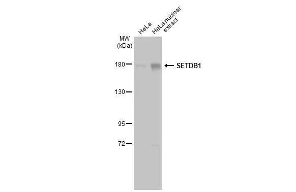 HeLa whole cell and nuclear extracts (30 ug) were separated by 5% SDS-PAGE, and the membrane was blotted with SETDB1 antibody [N2C1], Internal (NBP2-20322) diluted at 1:1000. The HRP-conjugated anti-rabbit IgG antibody  was used to detect the primary antibody. 