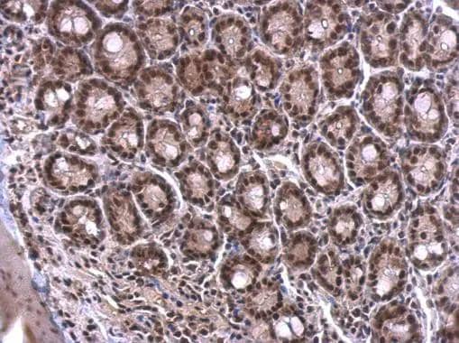 SF2 antibody detects SF2 protein at nucleus on mouse duodenum by immunohistochemical analysis. Sample: Paraffin-embedded mouse duodenum. SF2 antibody (NBP2-20324) dilution: 1:500. Antigen Retrieval: Trilogy(TM) (EDTA based, pH 8.0) buffer, 15min 