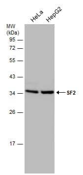 Various whole cell extracts (30 ug) were separated by 12% SDS-PAGE, and the membrane was blotted with SF2 antibody (NBP2-20324) diluted at 1:5000. The HRP-conjugated anti-rabbit IgG antibody  was used to detect the primary antibody. 