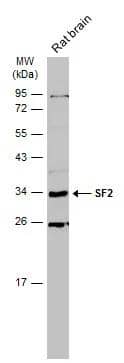 Rat tissue extract (50 ug) was separated by 12% SDS-PAGE, and the membrane was blotted with SF2 antibody (NBP2-20324) diluted at 1:500. The HRP-conjugated anti-rabbit IgG antibody  was used to detect the primary antibody. 