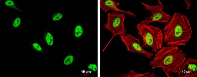 SFPQ antibody [N2C1], Internal detects SFPQ protein at nucleus by immunofluorescent analysis.Sample: HeLa cells were fixed in 4% paraformaldehyde at RT for 15 min.Green: SFPQ protein stained by SFPQ antibody [N2C1], Internal (NBP2-20329) diluted at 1:500.Red: phalloidin, a cytoskeleton marker, diluted at 1:200.Scale bar = 10 um. 