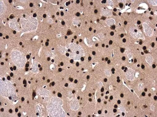 SFPQ antibody [N2C1], Internal detects SFPQ protein at cytoplasm and nucleus in mouse fore brain by immunohistochemical analysis. Sample: Paraffin-embedded mouse fore brain. SFPQ antibody [N2C1], Internal (NBP2-20329) diluted at 1:500. br>Antigen Retrieval: Citrate buffer, pH 6.0, 15 min 